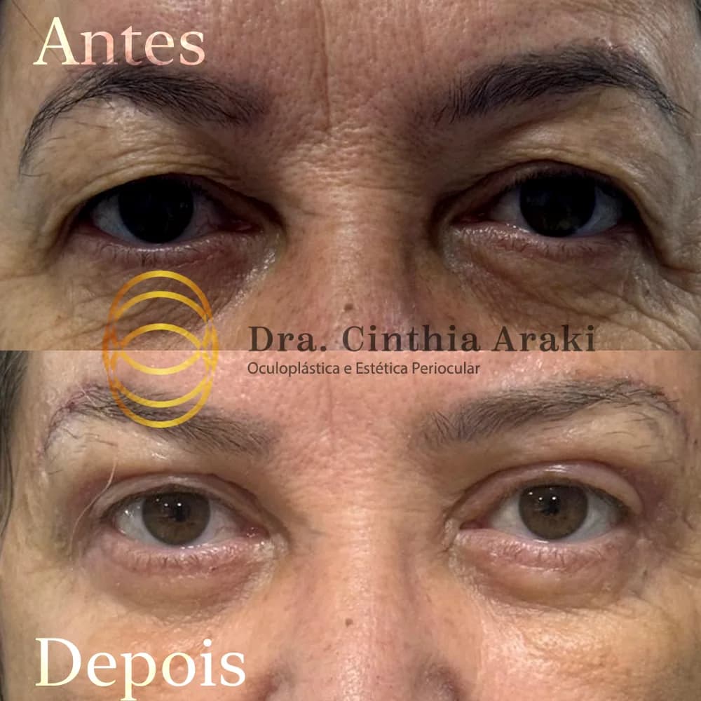 Antes e depois 1