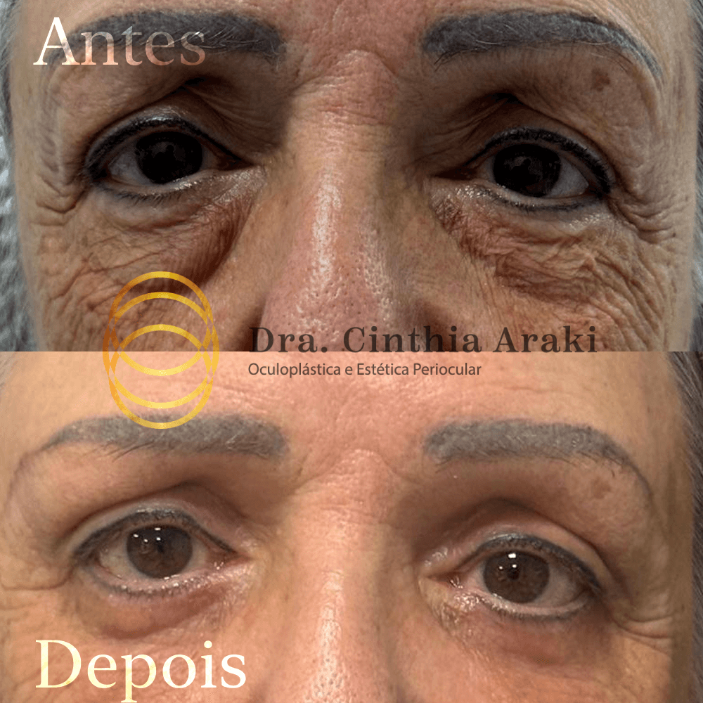 Antes e depois 3