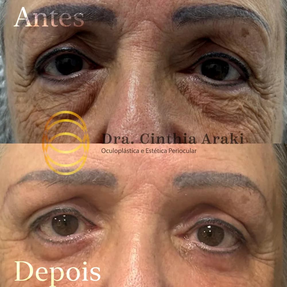Antes e depois 3