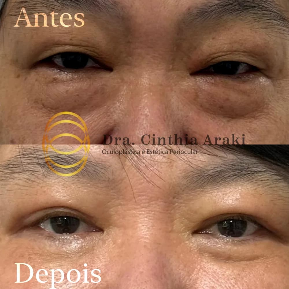 Antes e depois 4