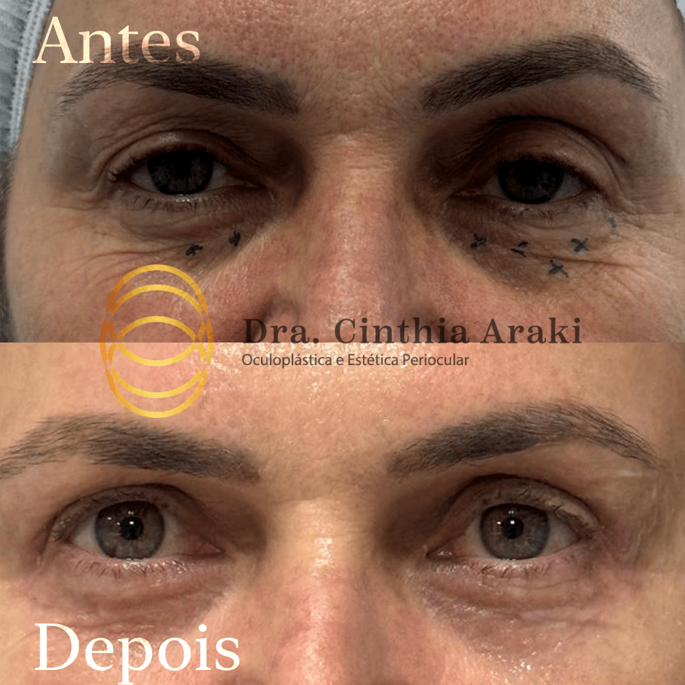 Antes e depois 5