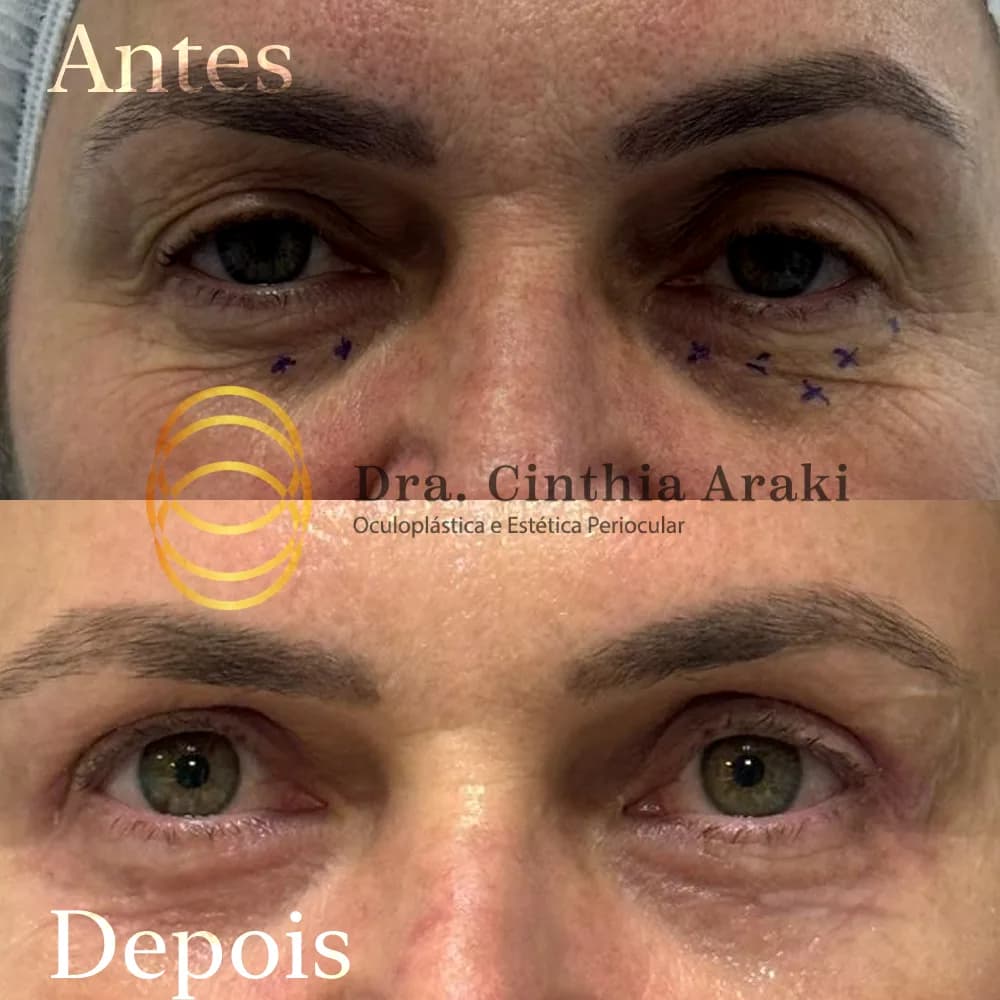 Antes e depois 5
