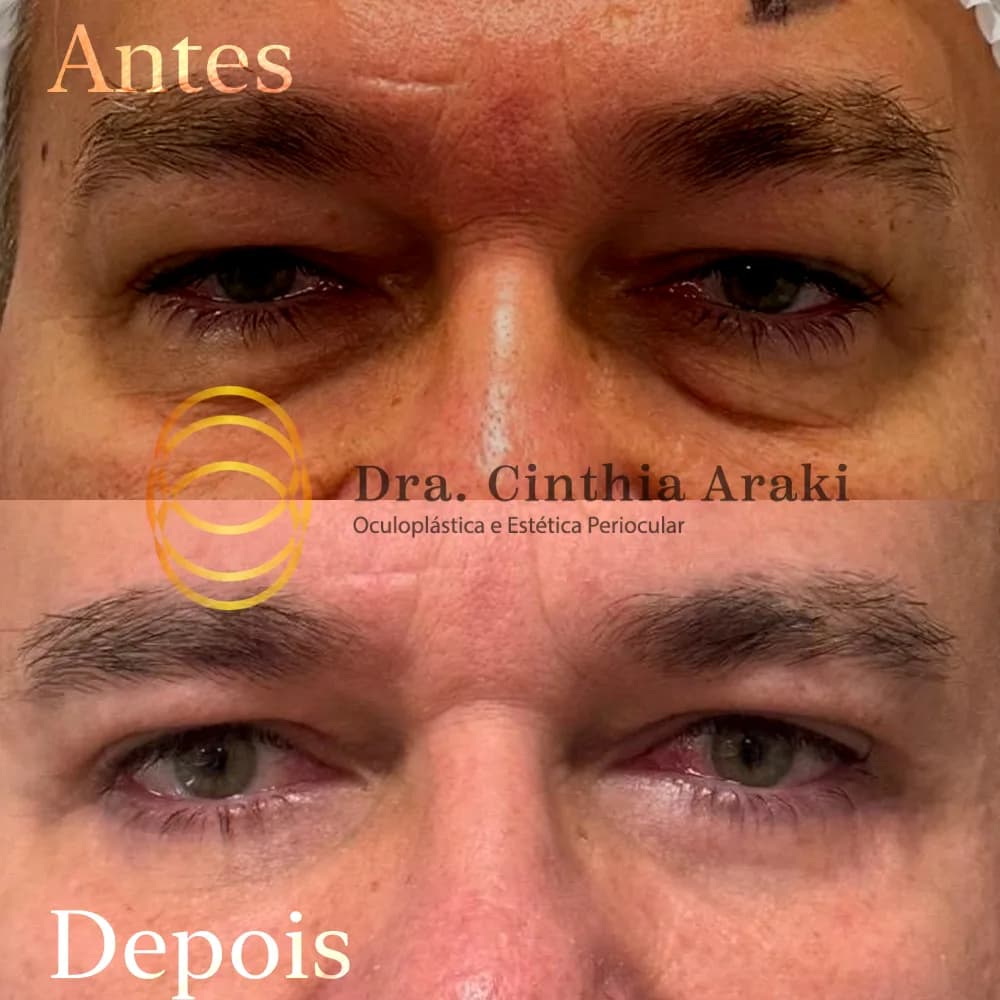 Antes e depois 6