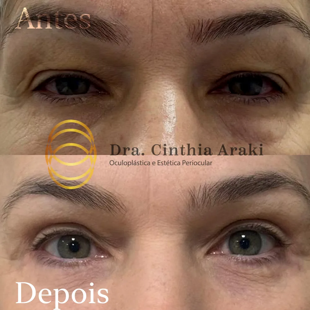 Antes e depois 7