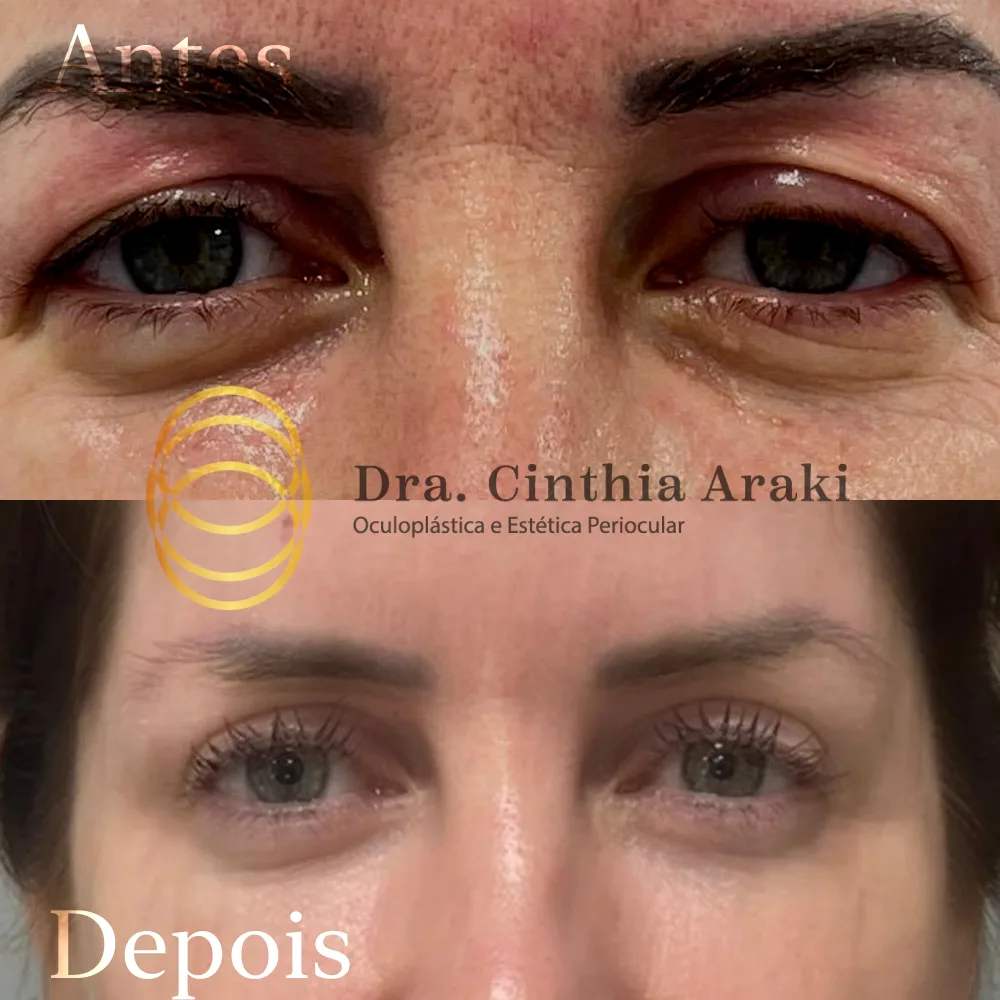 Antes e depois 8
