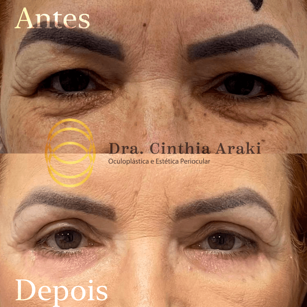 Antes e depois 9