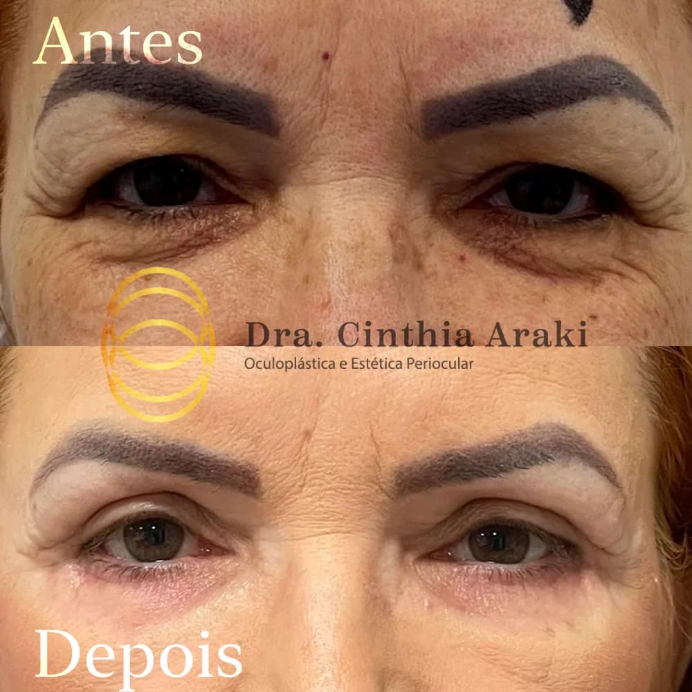 Antes e depois 9
