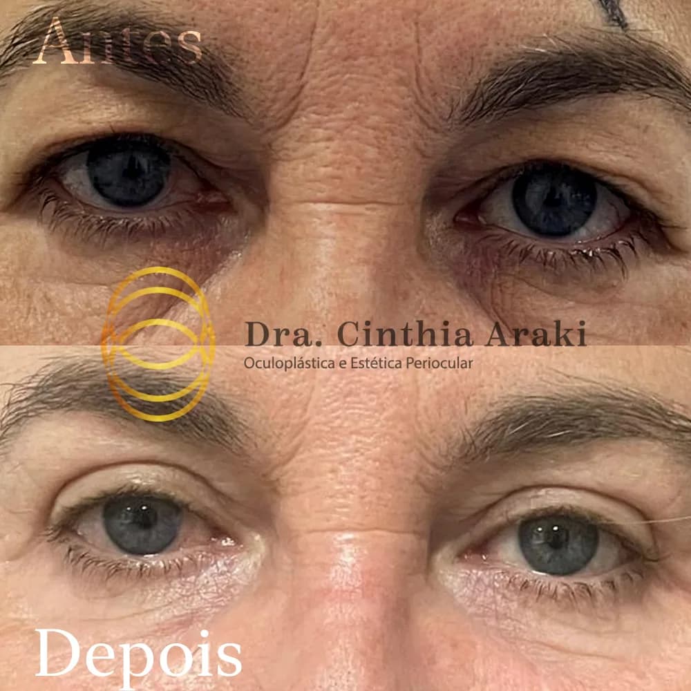 Antes e depois 10
