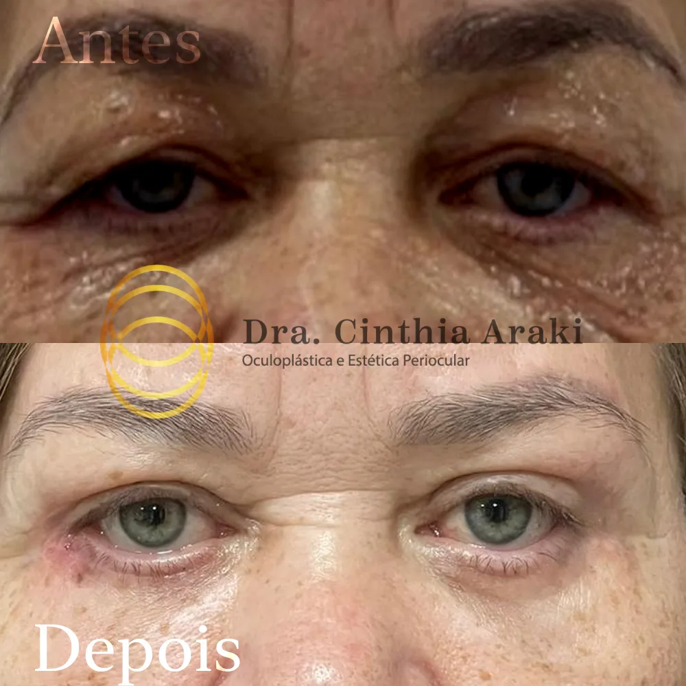 Antes e depois 12
