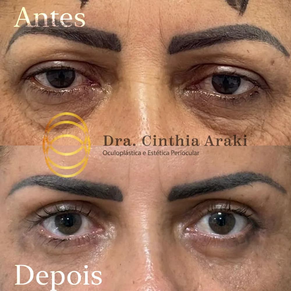 Antes e depois 13